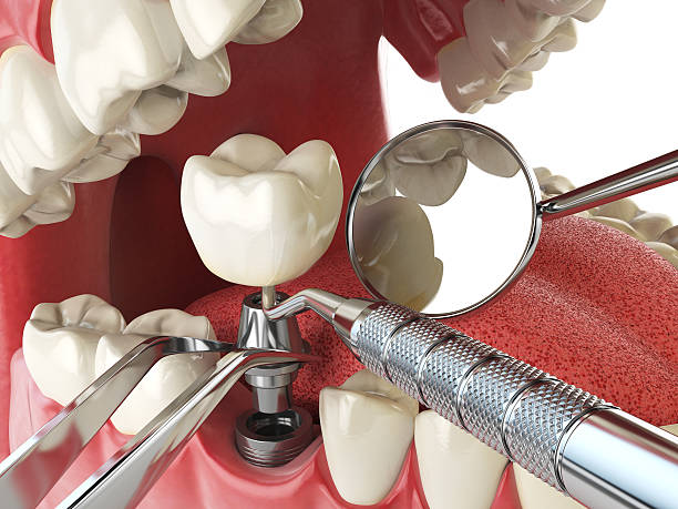 Best Same-Day Emergency Dental Services in Wallburg, NC